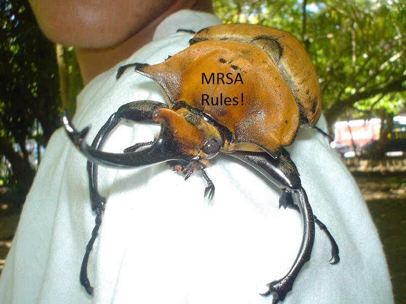 mrsa