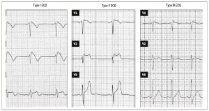 255v62n11-13145482fig1