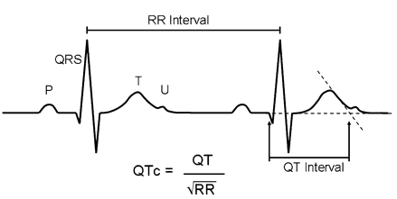 QTc image